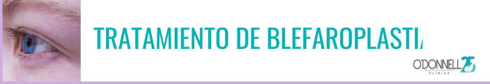 blefaroplastia mal hecha