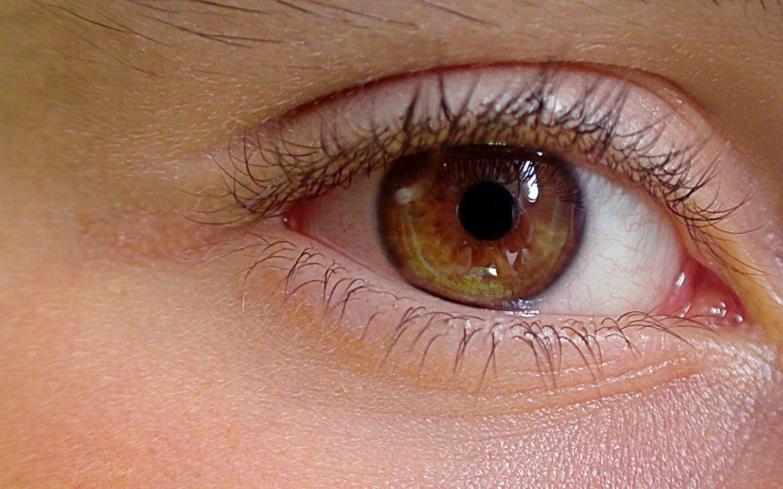 Consecuencias de una Blefaroplastia mal hecha